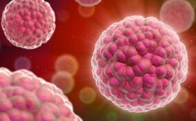 síntomas y tratamiento del virus del papiloma humano